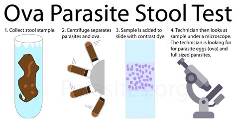 alcorfix|Ova and Parasite Exam, Fecal (Immunocompromised or Travel。